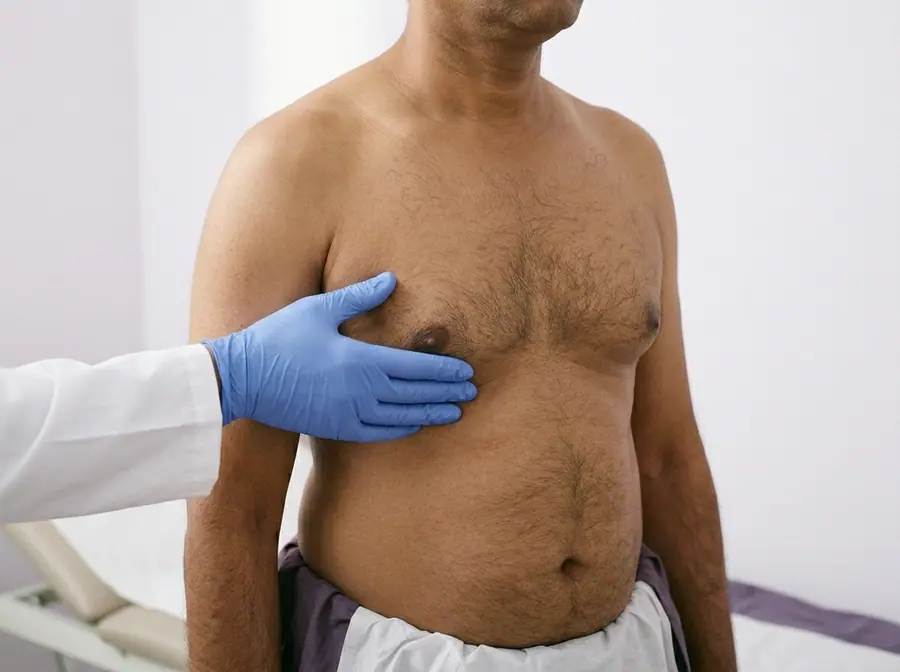 A doctor examining a man's chest for enlarged breast tissue (illustrative photo)