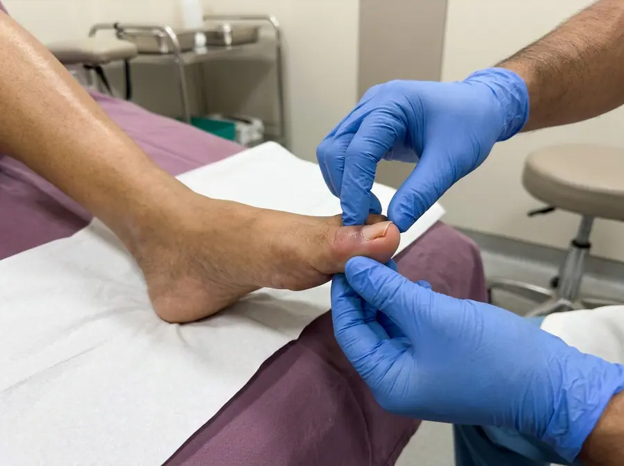 A doctor examining a red, swollen big toe with an ingrown nail (illustrative photo)