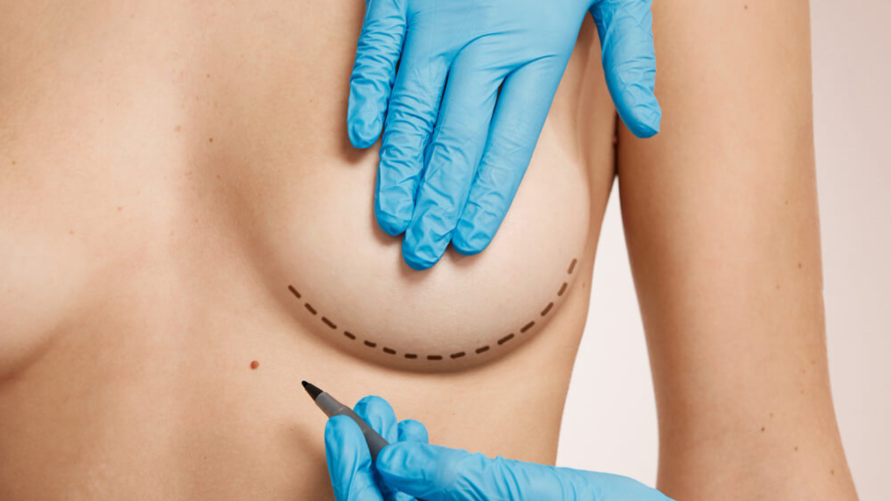 Breast Implantation