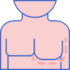 Gynaecomastia