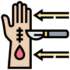 Hand Surgery