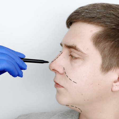 Rhinoplasty Banner