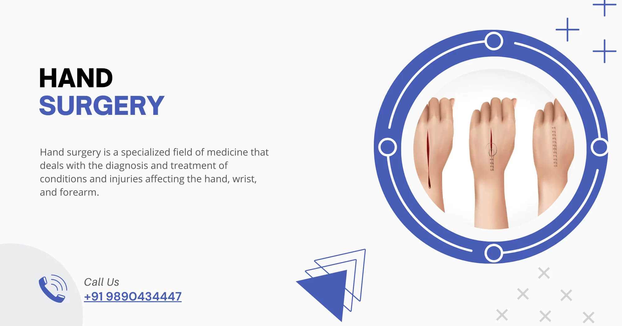 Hand-Surgery-Dr-Service
