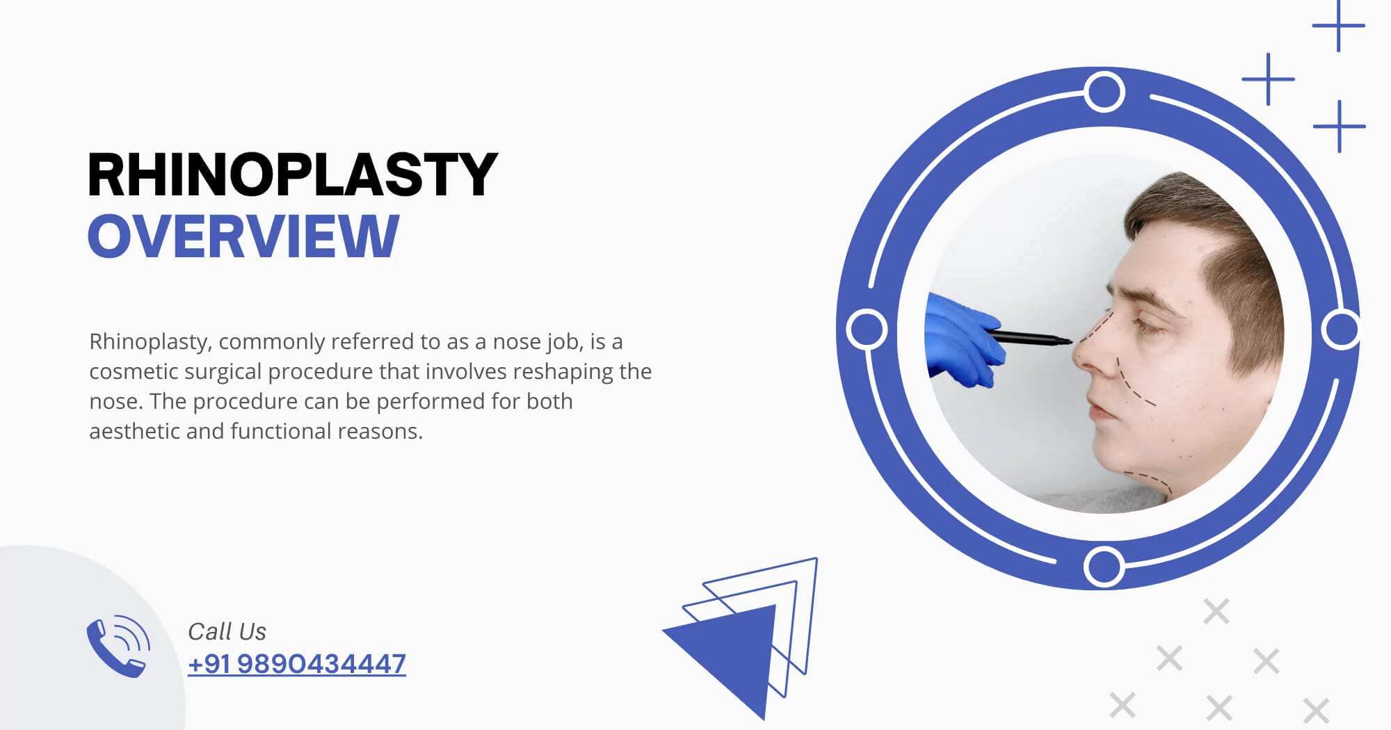 Rhinoplasty-Overview-Dr-Service