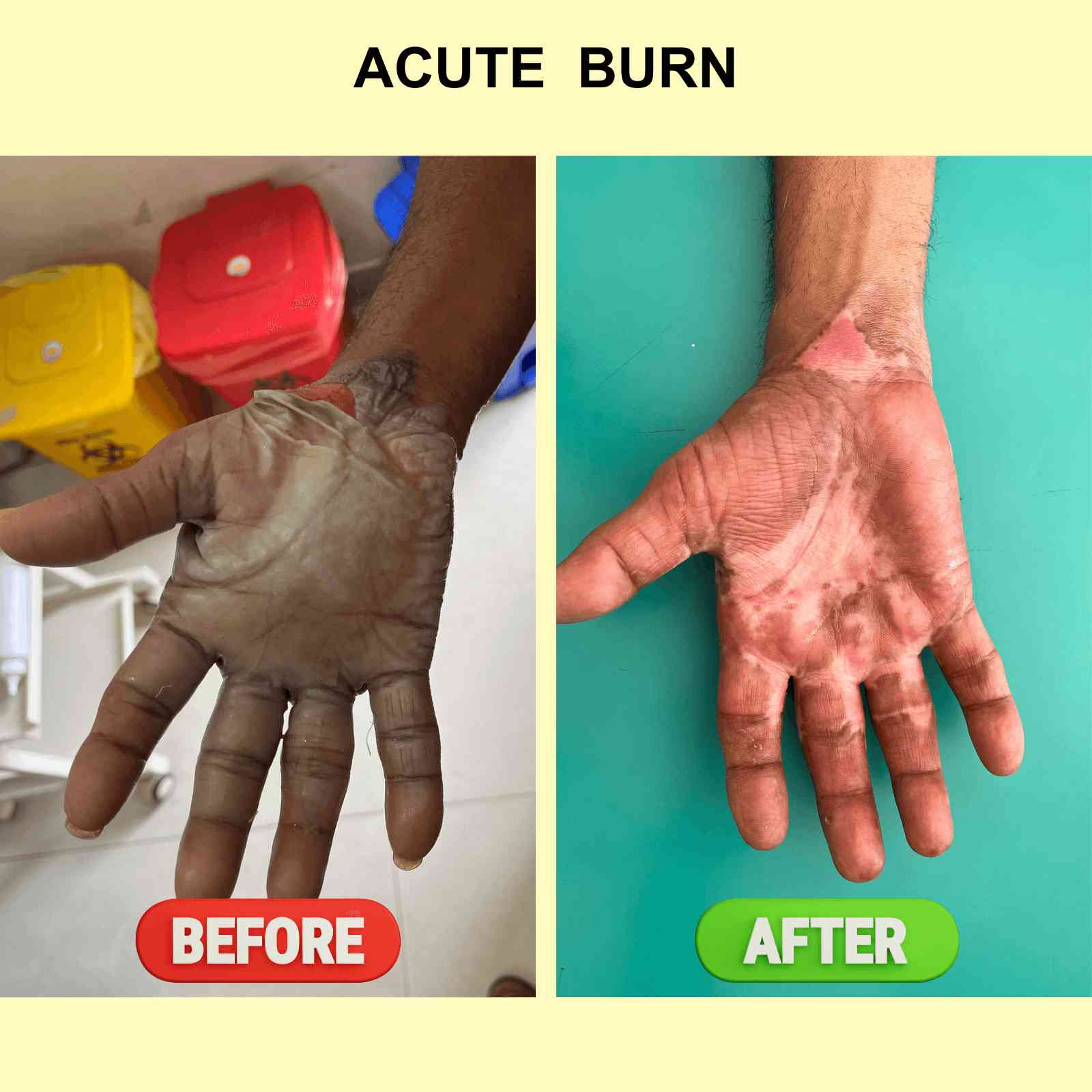 Best Plastic Surgeons In Pune No 1 Plastic Surgeon in India