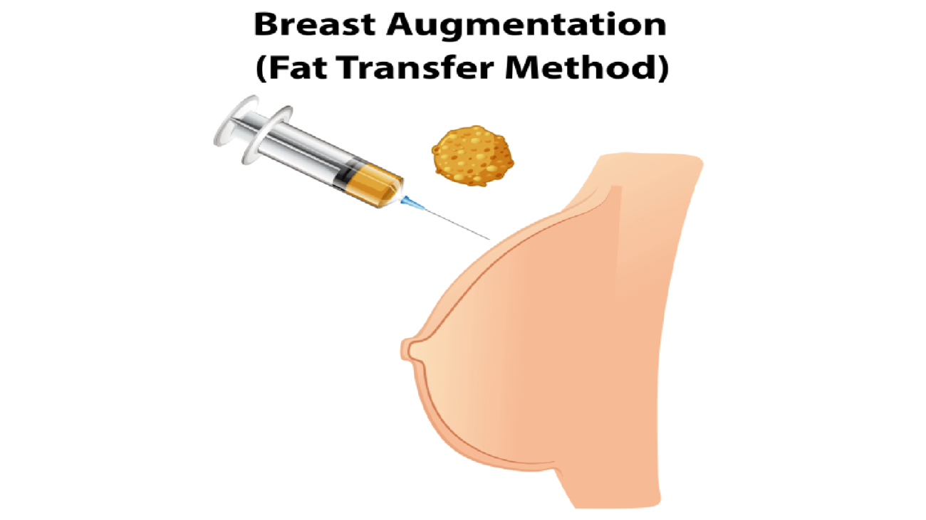 Breast Reduction Surgery
