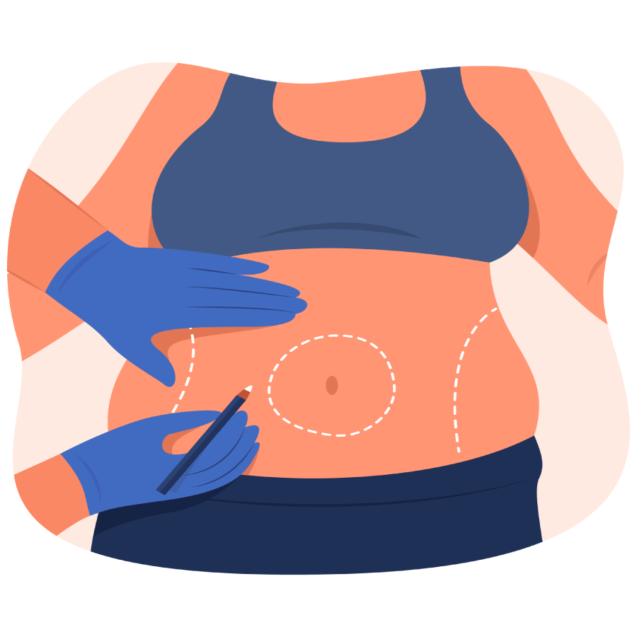 Tummy Tuck Surgery