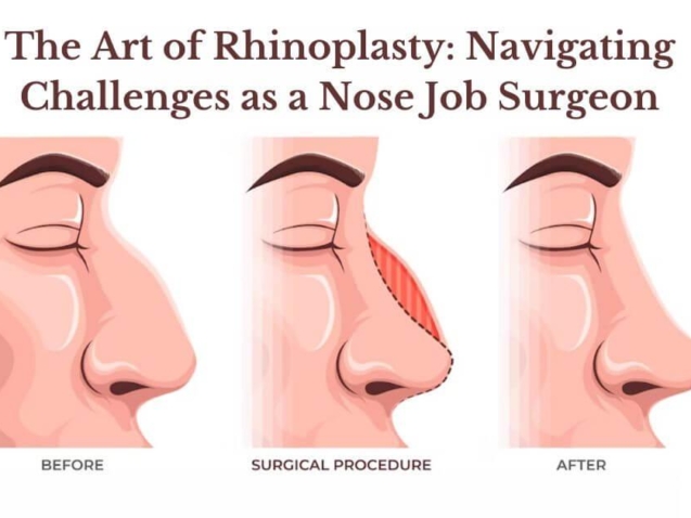 The-Art-of-Rhinoplasty-Navigating-Challenges-as-a-Nose-Job-Surgeon